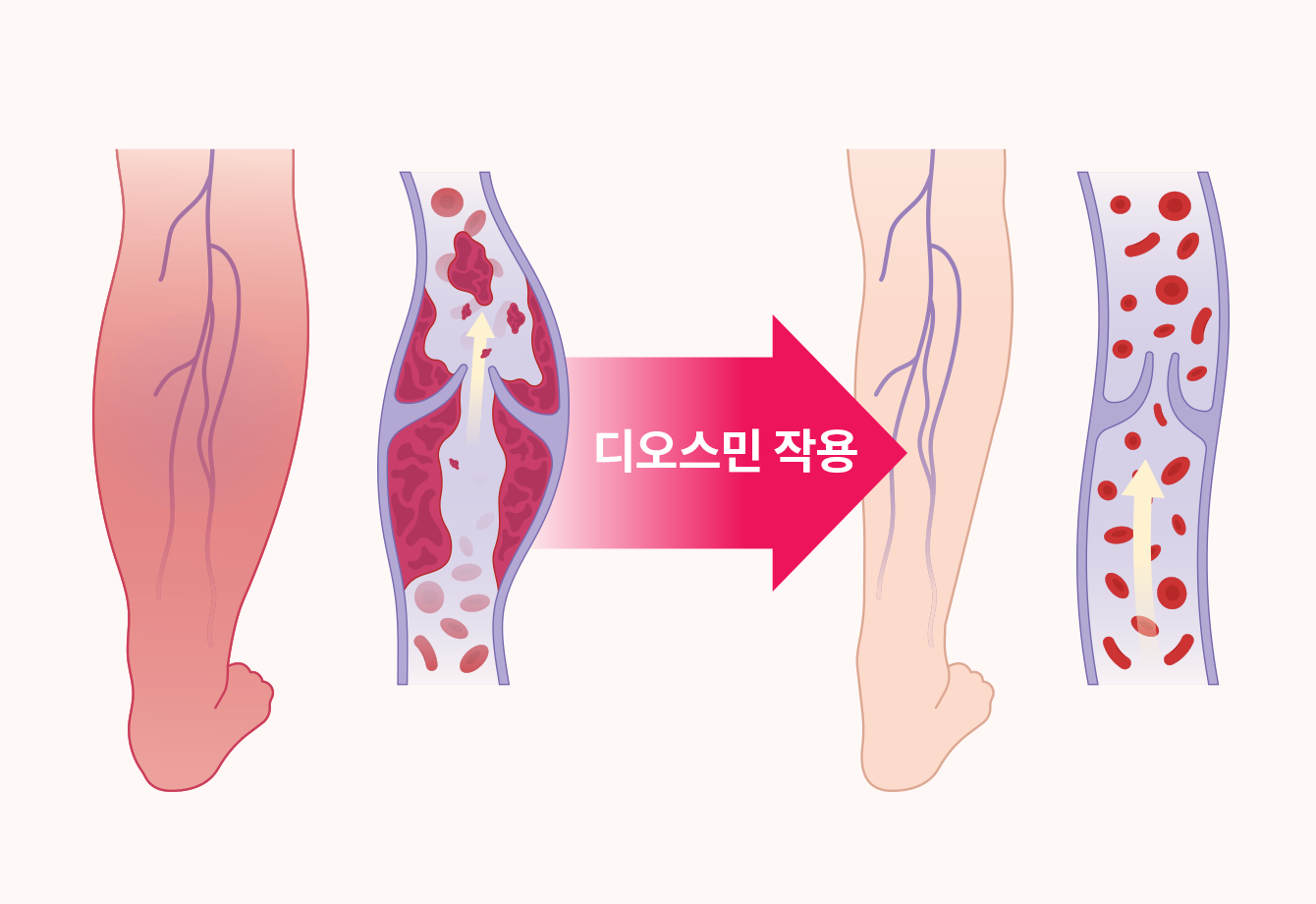 디오스민 작용