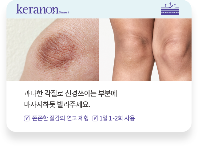 케라논 사용 방법