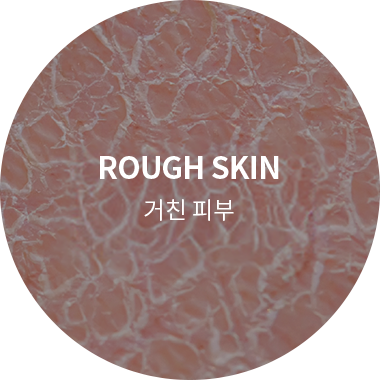 거친피부