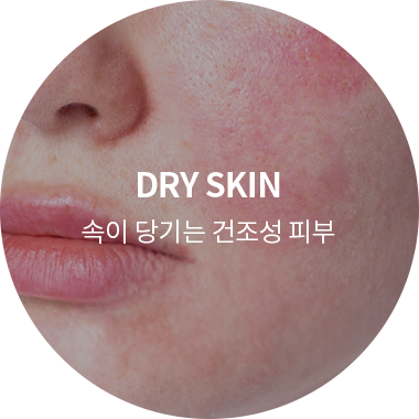 속이 당기는 건조성 피부
