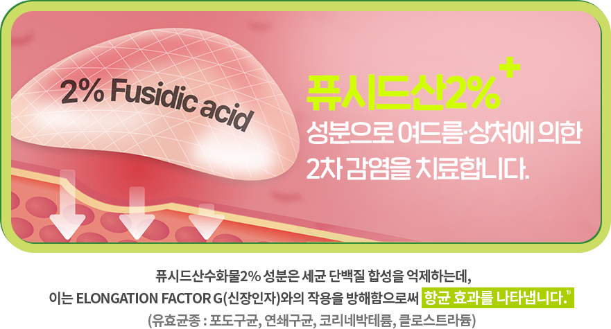 노스카딘 효과 이미지