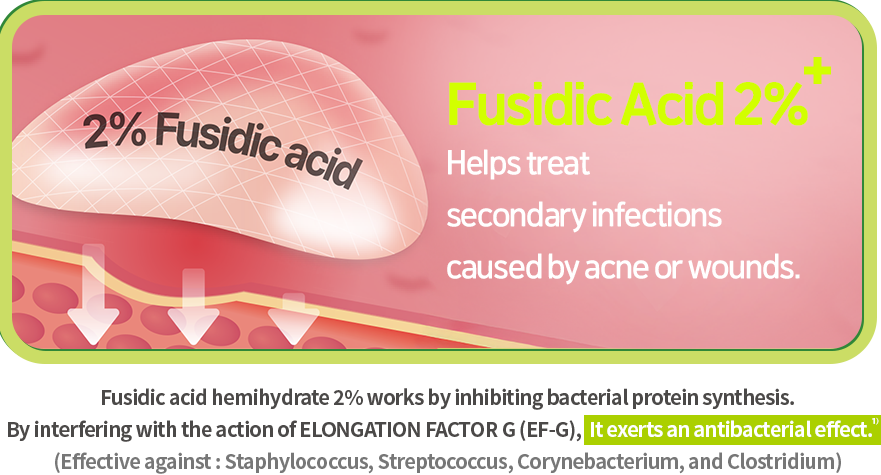 노스카딘 효과 이미지