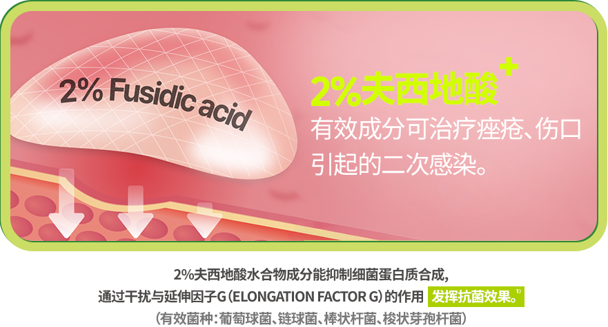 노스카딘 효과 이미지