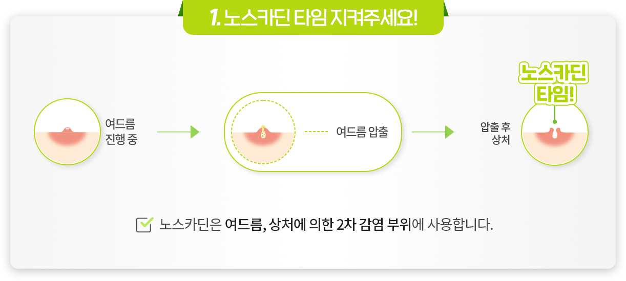 Point01 노스카딘 타임 지켜주세요
