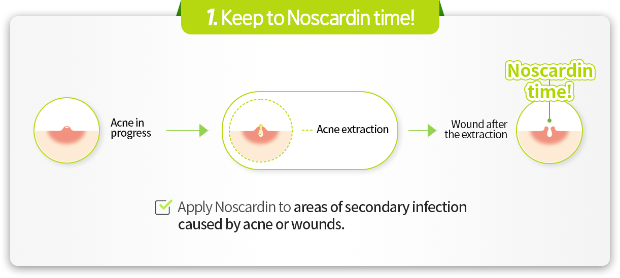 Point01 노스카딘 타임 지켜주세요