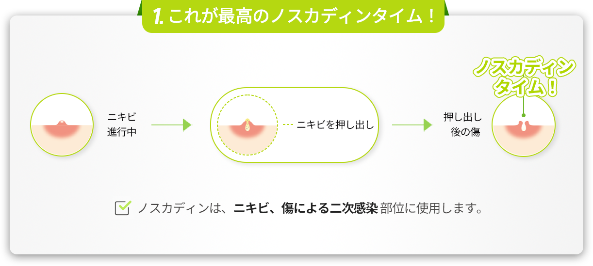 Point01 노스카딘 타임 지켜주세요