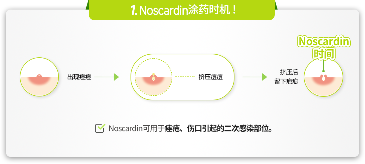 Point01 노스카딘 타임 지켜주세요