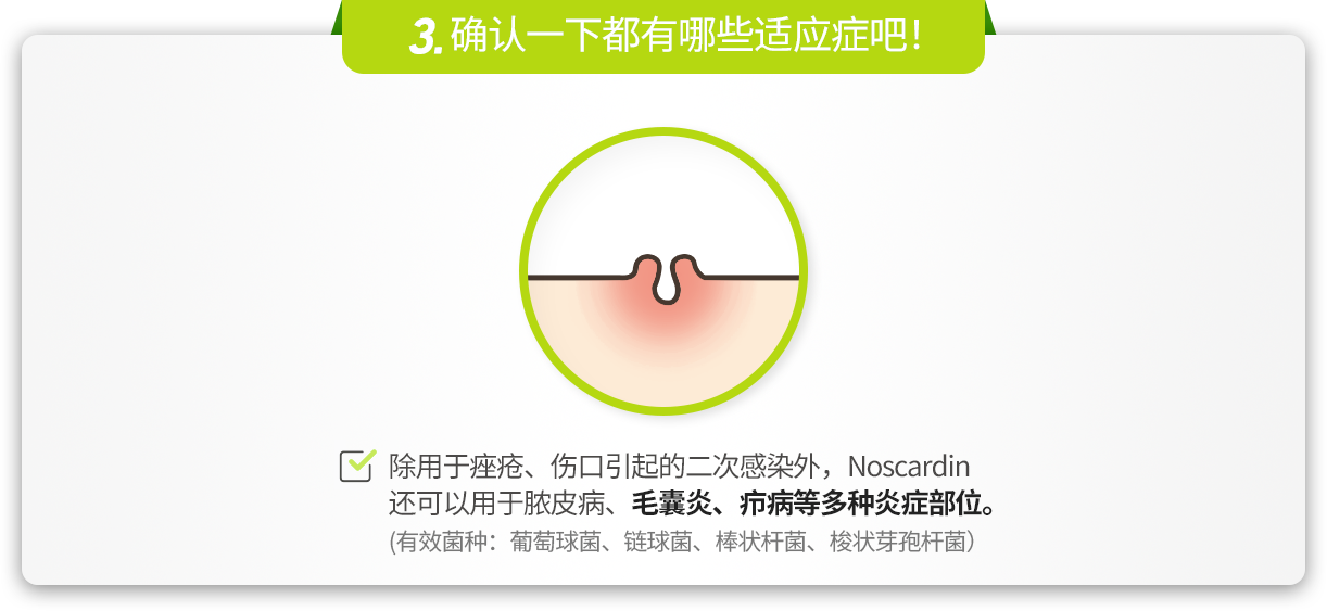 Point01 다양한 염증부위에 바르자!